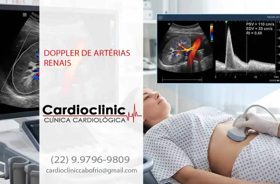 Doppler de Artérias Renais